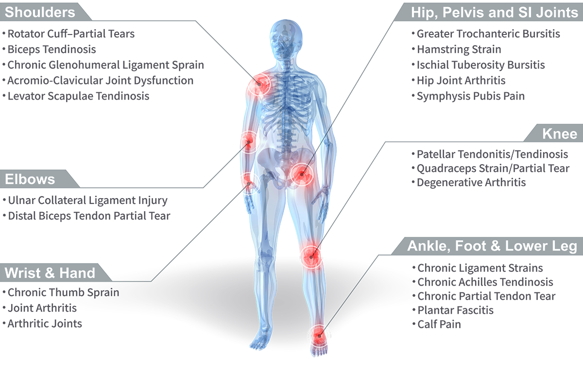 stem cell treatment joints