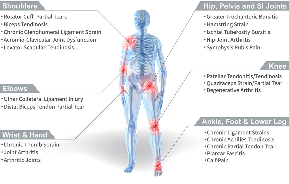 Stem Cell Joint